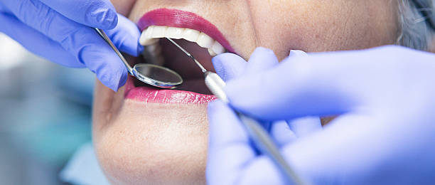 Best Emergency Broken Tooth Repair in Springville, IA